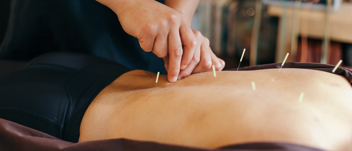 Athletes and Acupuncture